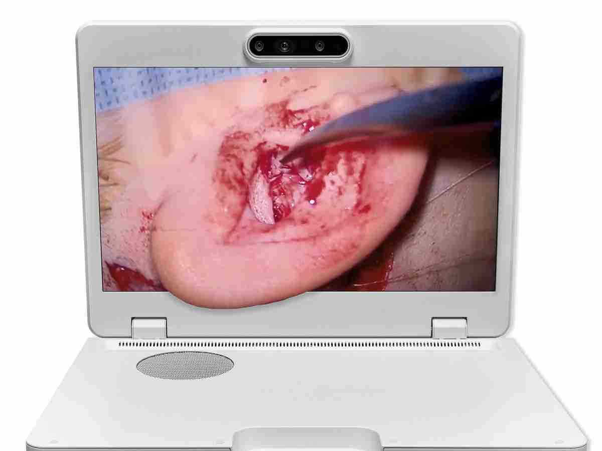 达擎之＂Heads-up 3D显微手术显示系统＂，，，整合4K裸眼3D显示及眼球追踪系统，，具备快速追踪人眼移动位置功能，，，减轻医师长时间维持固定姿势的负担，，让医师能有更宽广清晰的3D立体视野及更舒适的姿势来执行手术。。。。